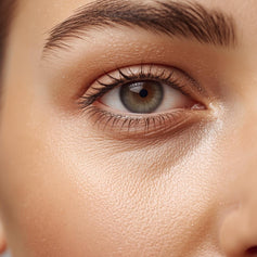 Dark Circles