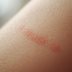 Scar Care